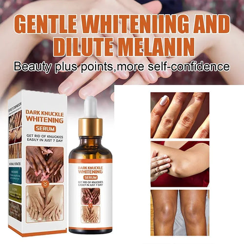 Skin Whitening Cream